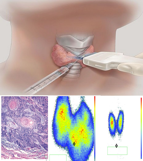 Відділ ендокринної хірургії